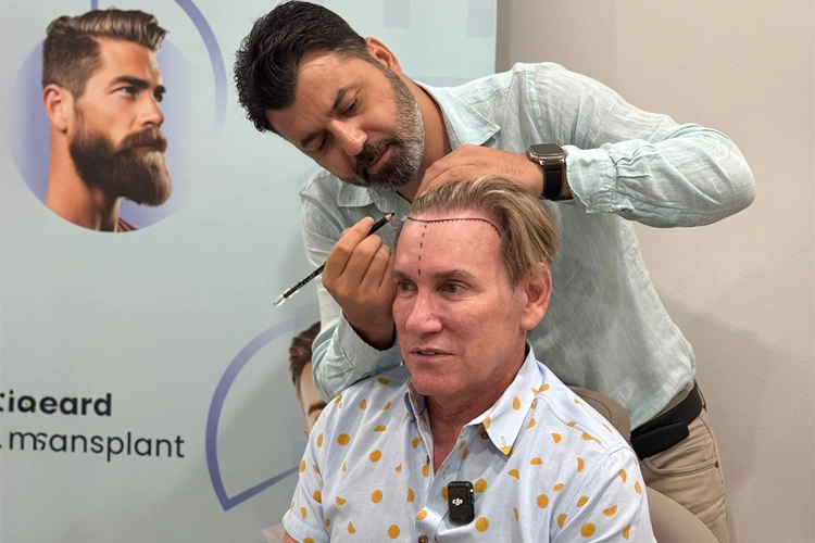 How to Perform Hair Analysis in Hair Transplantation